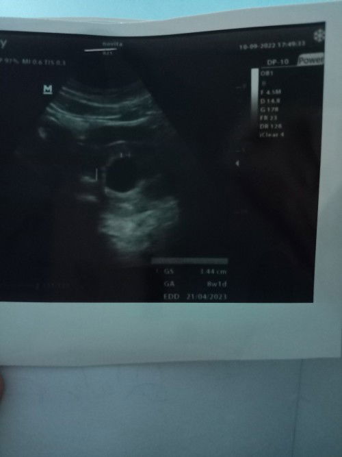 Vonis BO 😭😭😭😭😭