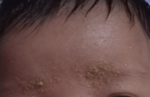 SOMETHING ON MY BABY'S FOREHEAD
