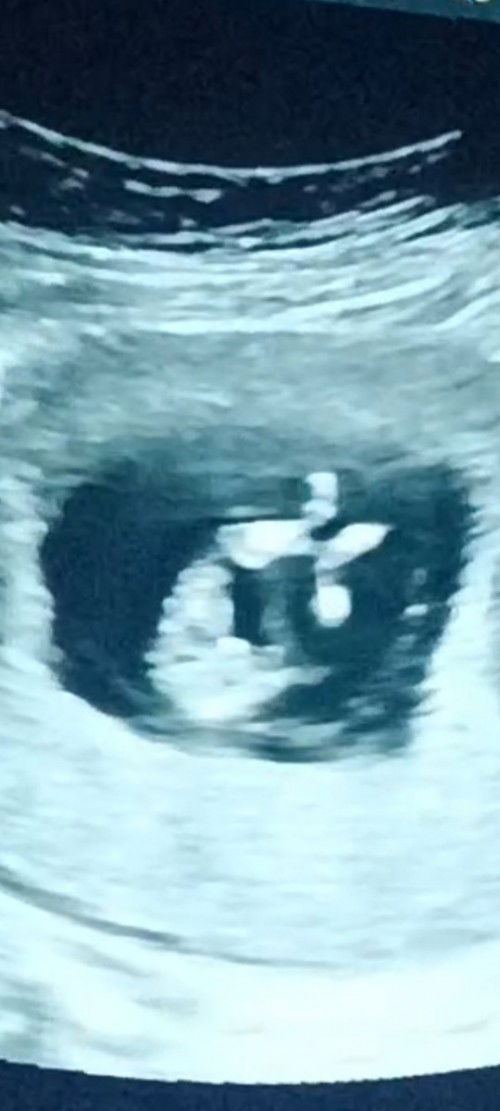 อยากสอบถามแม่ๆ ว่าเพศไหนค่ะ