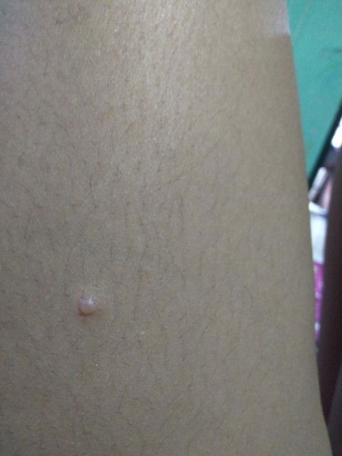 Bintik berair

Bund² mau tanya, hamil 10 minggu tapi muncul bintik berair, kenapa yaa ?