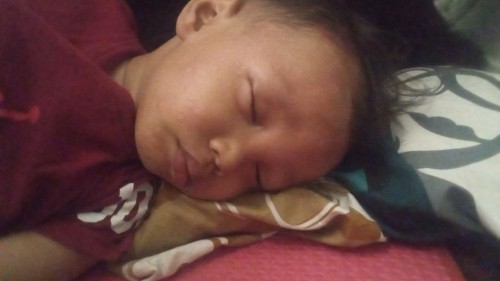 Biduran di muka obat ny apa ya bun
