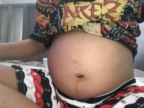 30+4w ท้องเล็กไปรึป่าวคะ แม่ๆทีมพฤศจิกายนมาอวดท้องกันหน่อยค่ะ🥺❤️👶🏻