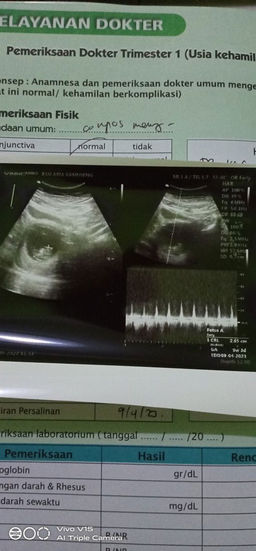 Hitung usia kehamilan