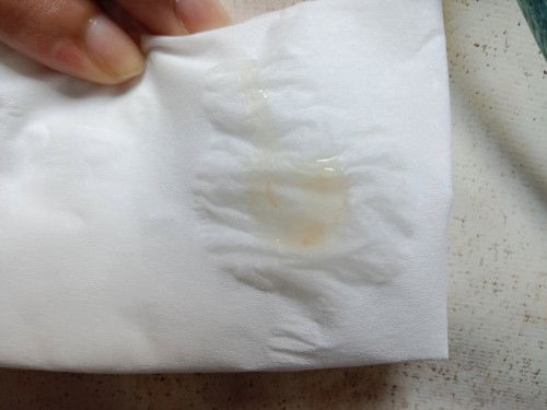 ใช่มูกเลือดมั้ย