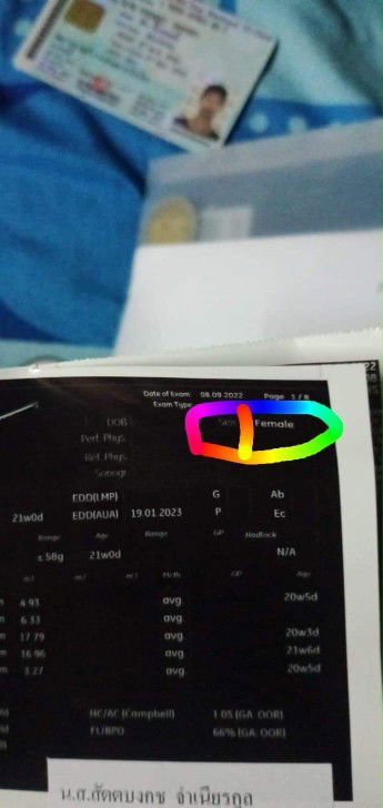 สอบถามหน่อยค่ะ หมอบอกลูกเพศชาย ทำไมในใบซาวเขียนเพศหญิงค่ะ หรือว่าไม่ได้ดูตรงนี้