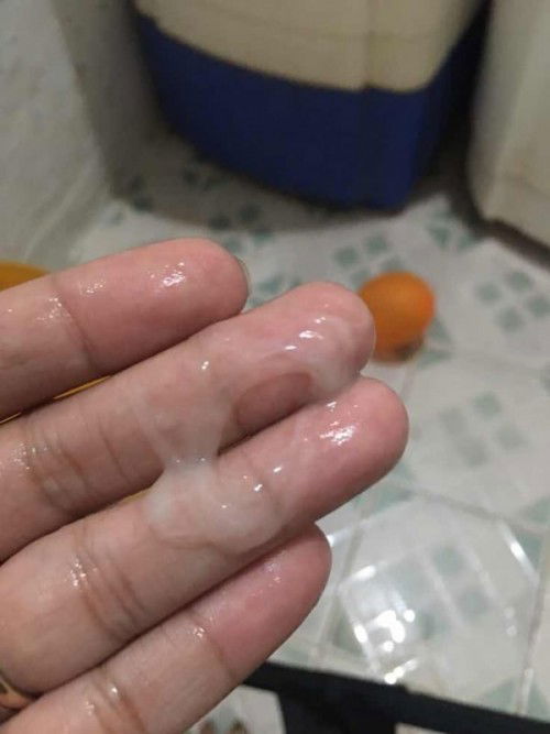 spotting 3months preggy