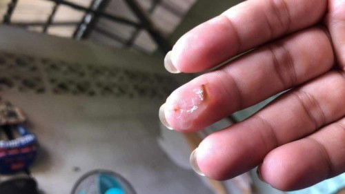 ขอถามเเม่ๆหน่อยจ้า มีมูกเเบบนี้ออกมา ไม่มีอาการเจ็บท้องไม่มีน้ำเดิน เเต่มีเเบบนี้ออกมา ต้องทำยังไงค่