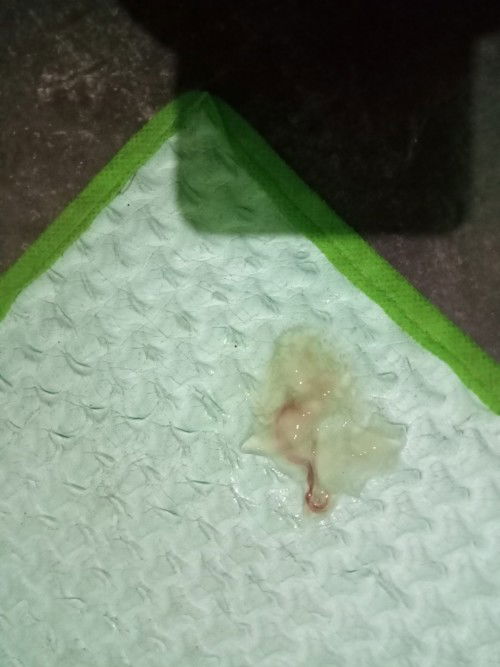 Bun Saya Mau Tanyak Nie Kalau Keluar Lendir Bercampur Gini Itu Tandanya Apa Ya Bun
