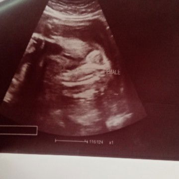 Sa nakaka Alam po.. Anu po ba gender nyan ksi unang result na binigay sakin lalaki tapos pinalitan