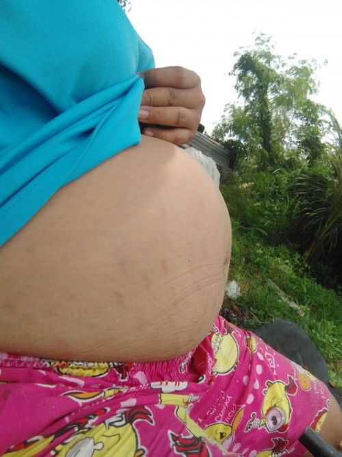 ท้องไม่ลดท้องกลม