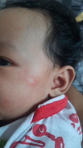 Ringworm help!