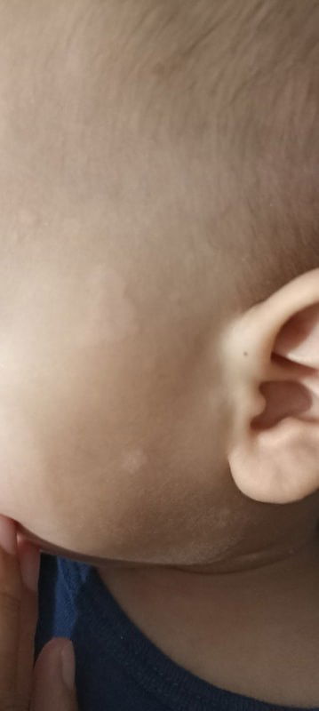 Muka anak ada putih2nya