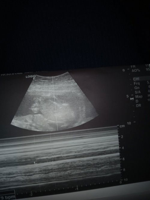 Baka possible may marunong tumingin dito if ano gender ng baby ko