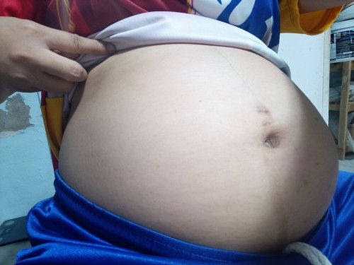 32+6 Week แล้ว