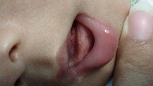 ada putih digusi