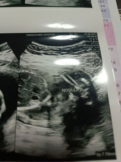 อยากให้ช่วยดูเพศตัวน้อยคะ