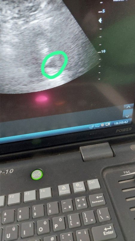 Bingung mau liat yang mana dari aplikasi ini apa dari bidan