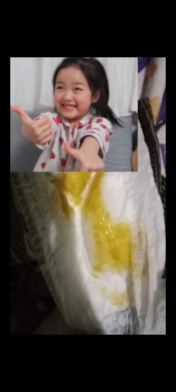 Bagaimana ciri ciri bayi 4 bulan lebih diare