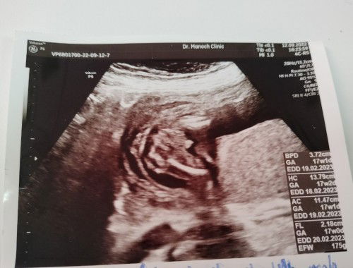 17wคะ ช่วยดูหน่อยจ้า ช.ญ
มีความหวังจิได้ลูกสาวไหมค่ะ เพราะคนแรกเป็นผู้ชายจ้า แต่ ออกมา.ช.ญ.ก็รักจ้า