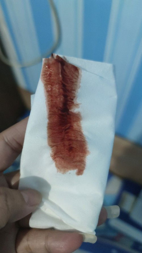 Khawatir apa yg hrs di lakukan?