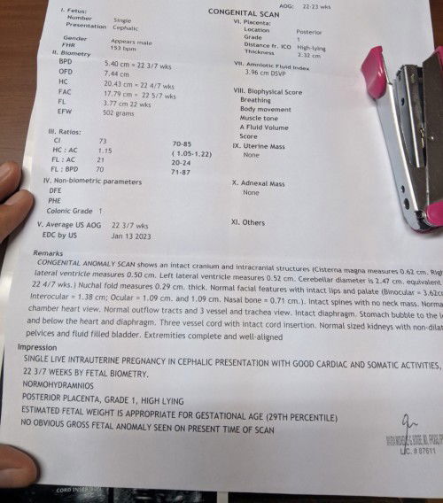 Hello po. Ask ko lang kung Okay naman po ba ang result ng CAS ko ? Salamat