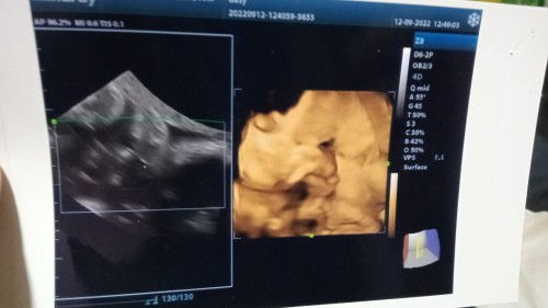 Bingung harus sedih atau bahagia