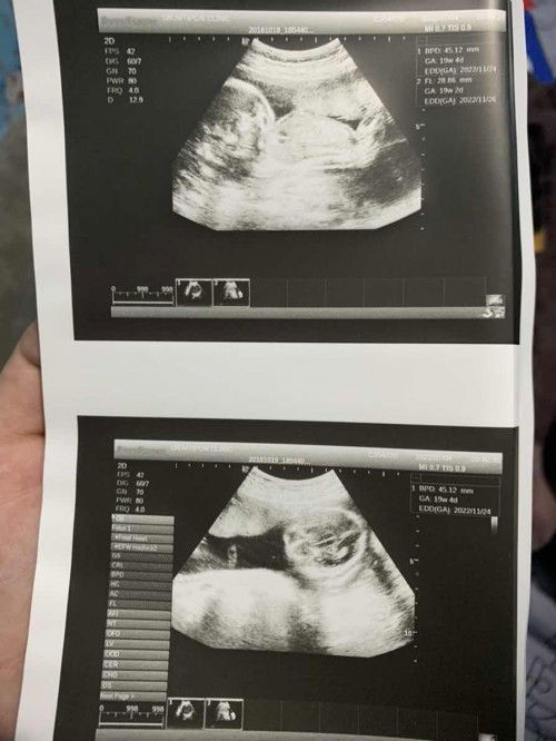 ขอคำเเนะนำแม่ๆที่ฝากคลีนิกพิเศษเหมือนกันหน่อยค่ะ