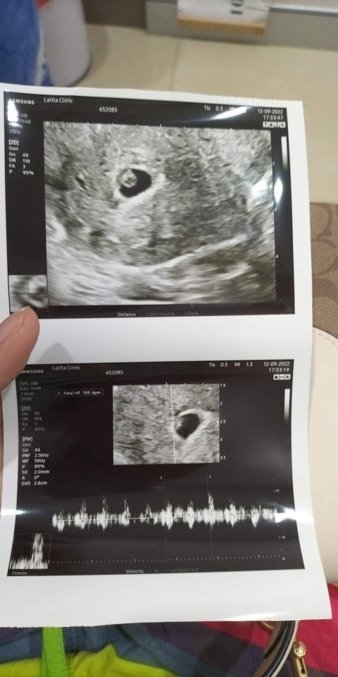 ตั้งครรภ์สอบถาม