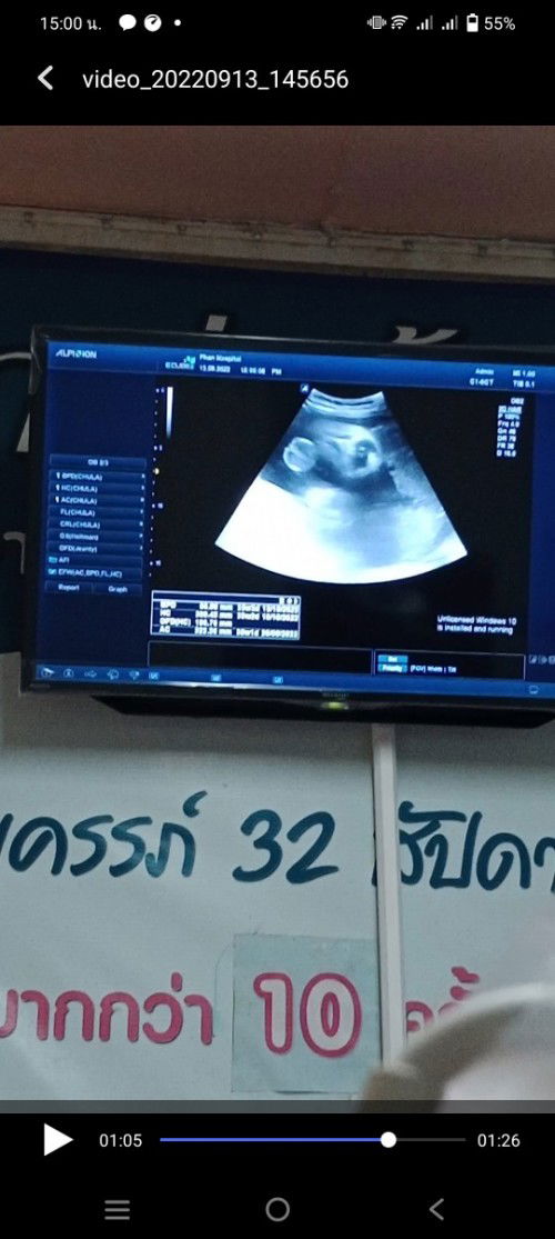 น้ำหนักลูก