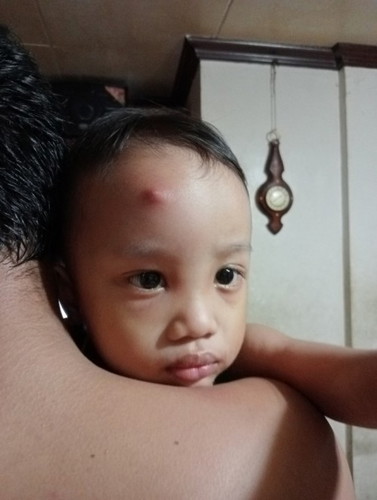 Tumubo sa mukha ng baby