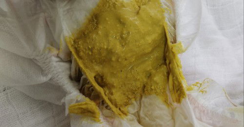 Normal ke najis warna nie.. baby baru 23hari.. fm + susu badan