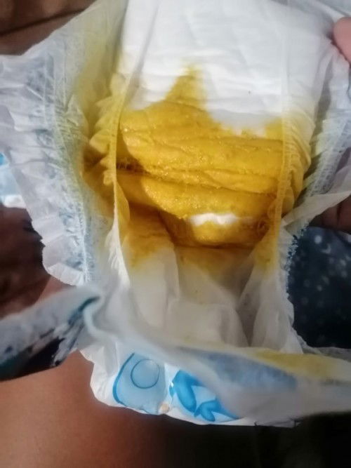 Magandang araw po, magtatanong lang po ako tungkol sa pag dumi ni baby..