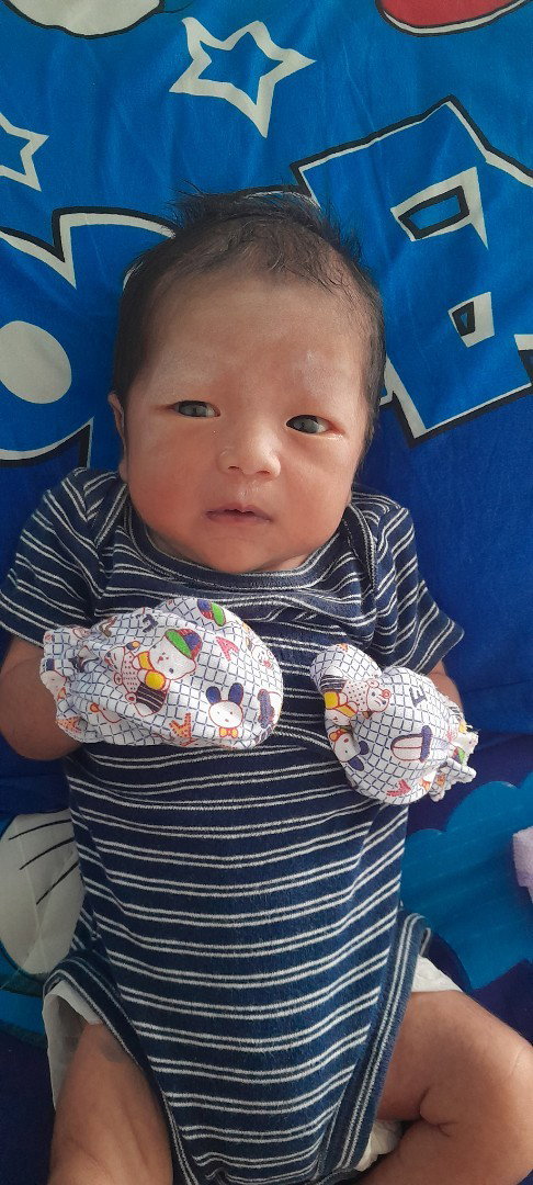 ปลูกฝีที่แขน