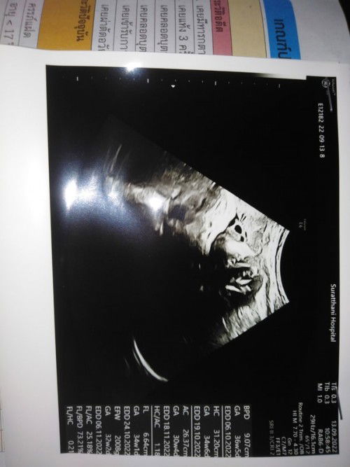 ขอสอบถามหน่อยค่ะ