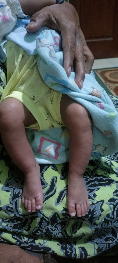 Bentuk kaki bayi 1 bulan 18 hari