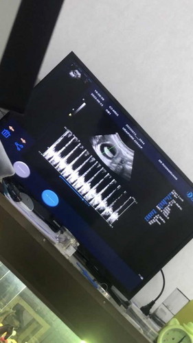 10week ซาว