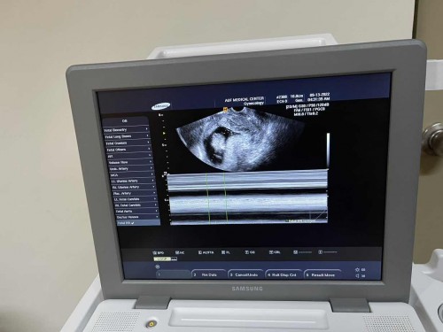 Hello po mga mommies sino po dito marunong basahin itong ultrasound po..