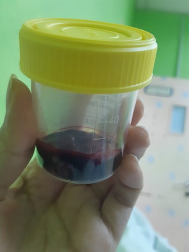keguguran 8minggu kandungan