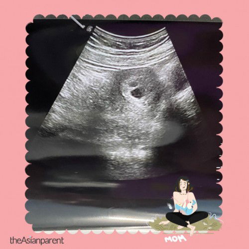 Hati terasa sangat risau normal ka macam ni