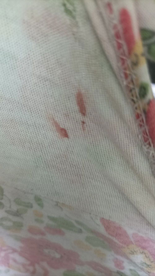 blood stains on undies during 33 weeks