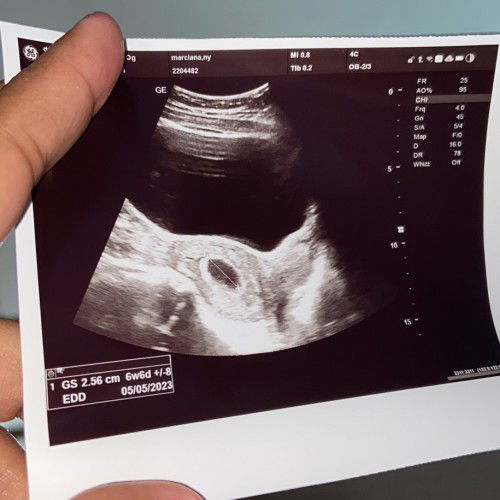 Menanyakan tentang hasil usg