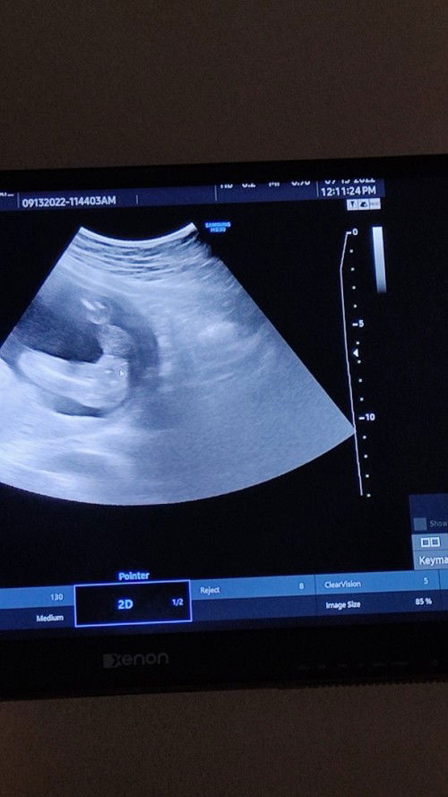 Baby girl ba talaga?..