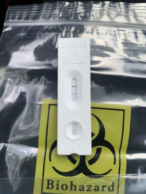 Positive Covid 19 at 24 weeks