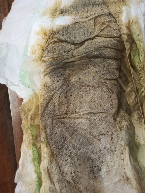 Normal lang po ang dumi ni baby?