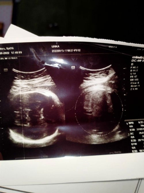 Kepala janin sudah dibawah