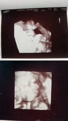 37+6wแล้วค่ะ