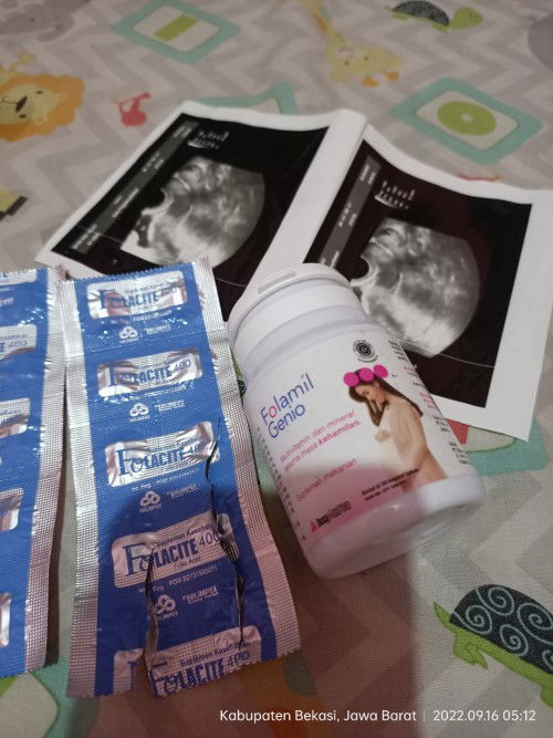 Trisemster pertama lebih bagus konsumsi asam folat atau cukup folamil genio ?