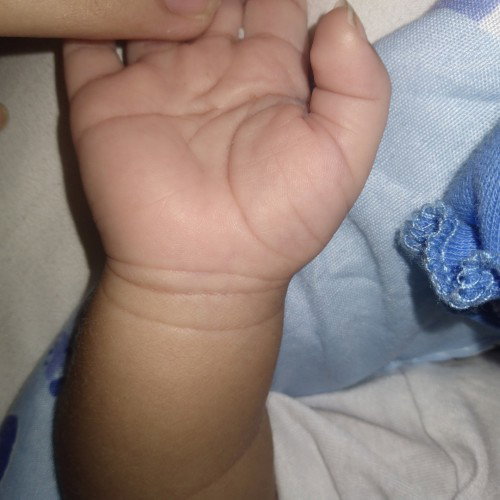Single crease po ba yung sa palm ni baby?