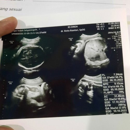 37weeks belum masuk panggul