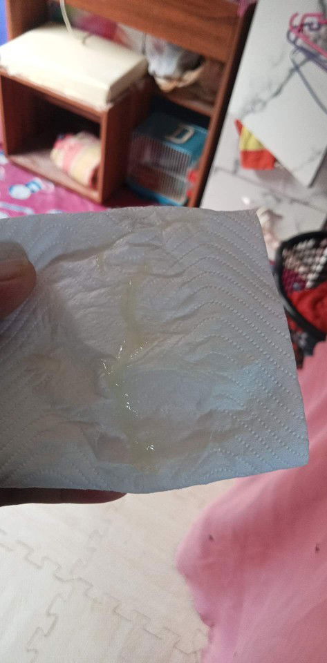 มีมูกแบบนี้ออกมาพอสมสวร